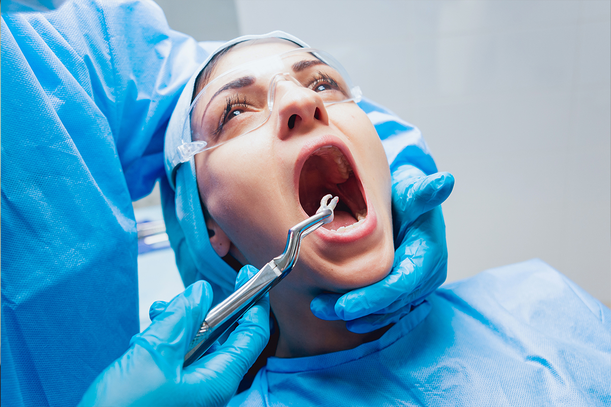 Tooth extraction