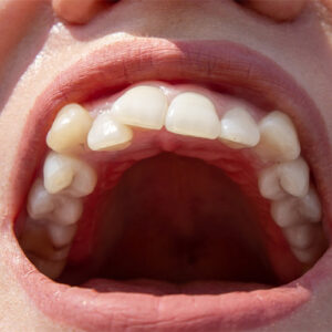 Orthodontic problem