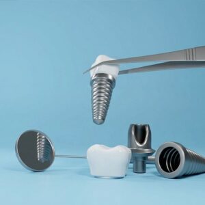 Why Dental Implants Are the Best Solution for Missing Teeth Abutment
