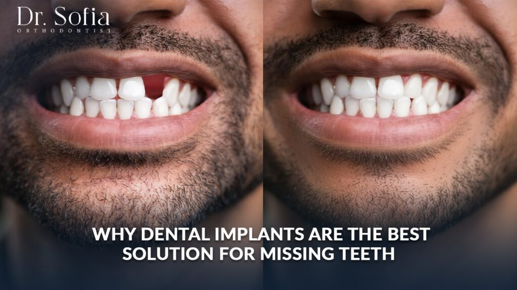 Why Dental Implants Are the Best Solution for Missing Teeth Dental Implants in Kolkata