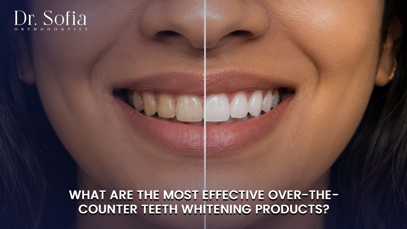 teeth whitening